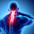 What does severe neck pain indicate?